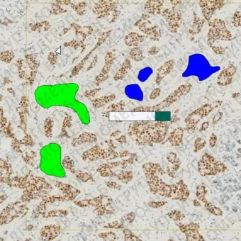 Модуль программного обеспечения для онкологии ONCOTOPIX