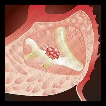 Реактив моноклональное антитело CA199  Antibodies