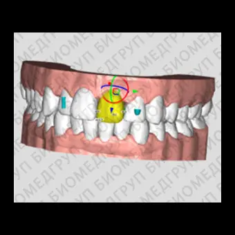 Программное обеспечение для стоматологических лабoраторий DELTAFACE
