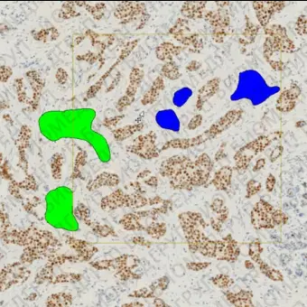 Модуль программного обеспечения для онкологии ONCOTOPIX