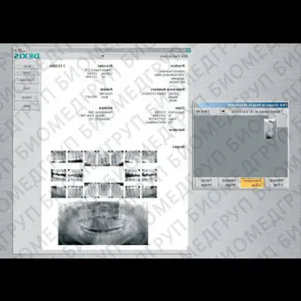 Программное обеспечение для обработки снимков зубов DEXIS