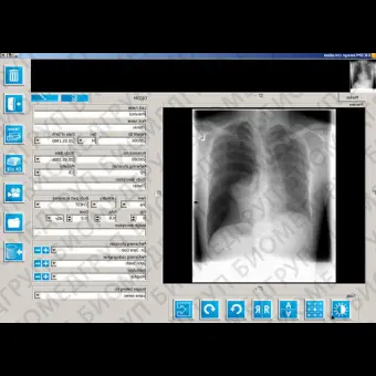 Программное обеспечение для медицинских снимков iQVIEW BASIC