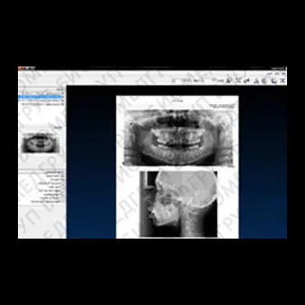 Программное обеспечение для обработки снимков зубов CLINIVIEW