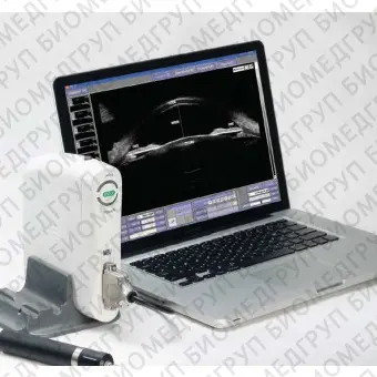 Переносной ультразвуковой сканер SW2000/SW21