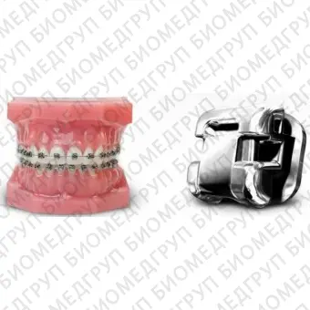 Damon Q брекет ортодонтический, паз 022 на правый премоляр верхней челюсти 14 и 15 зуб универсальный