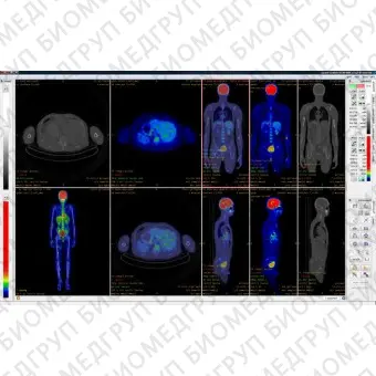 Программное обеспечение для медицинских снимков InterView FUSION