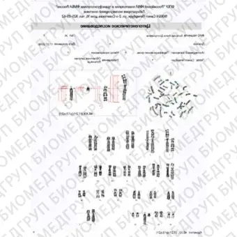 ПО для автоматического FISHанализа, АргусFISH, АргусСофт, FISH 2.1