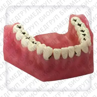 Модель верхней и нижней челюстей с 32 модельными зубами для лечения кариеса