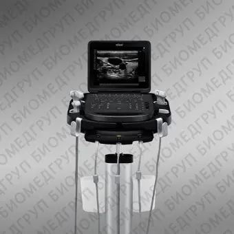 Переносной ультразвуковой сканер SonoSite Edgell