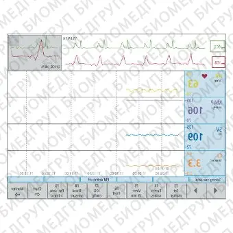 Электрокардиограф для спокойного состояния CardioScreen 2000