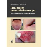 Заболевания слизистой оболочки рта. Связь с общей патологией. Диагностика. Лечение. / Цветкова А.А.